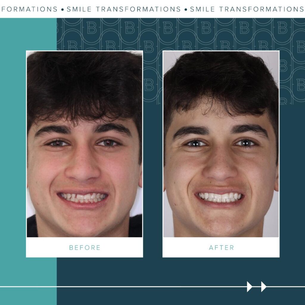 2023-11-06_Brady Ortho_1101 Before and After_BG-02