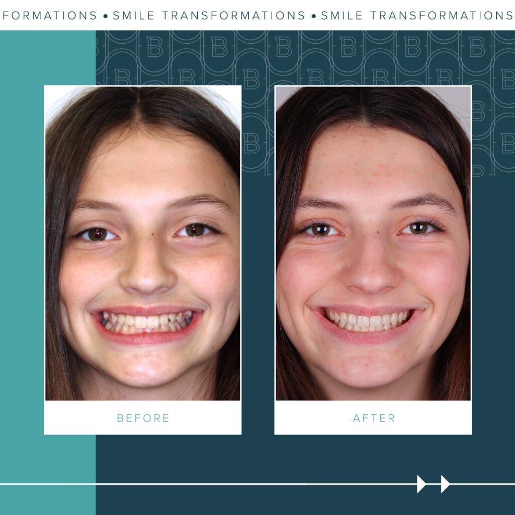2023-11-13_Brady Ortho_Olivia-Before and After_BG-02