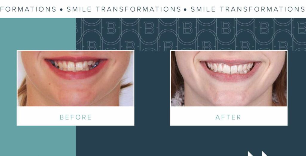 Orthodontist Office Evanston